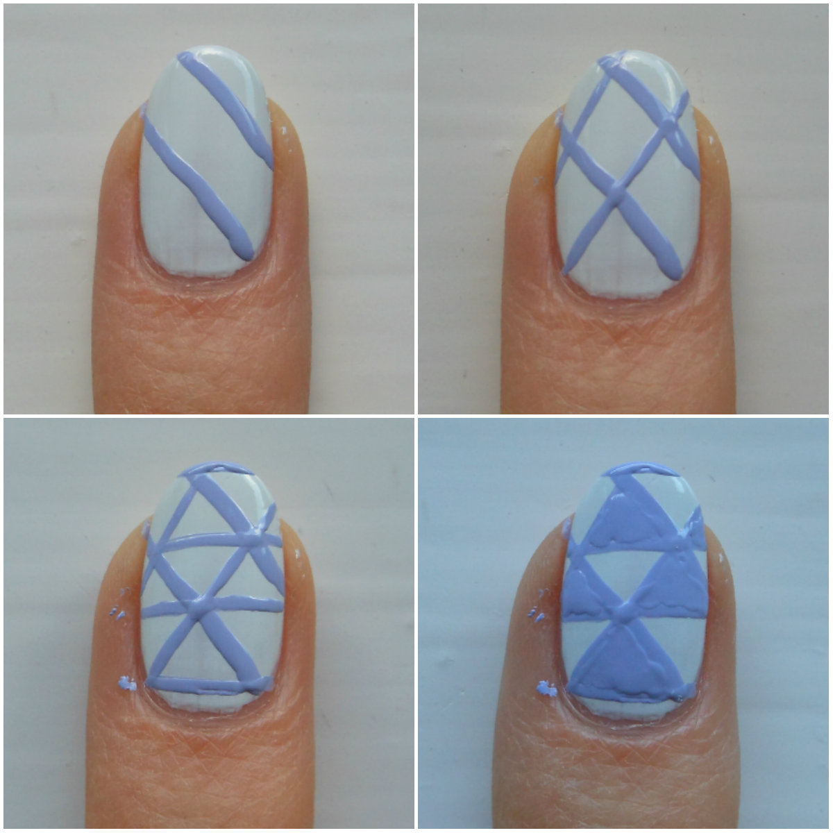 What Exactly Are Beau's Lines on Nails?