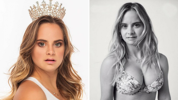 A 24-year-old model achieves her dream of being the first Down syndrome model for Victoria's Secret.