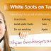 White Spots on Teeth and How to Remove Them