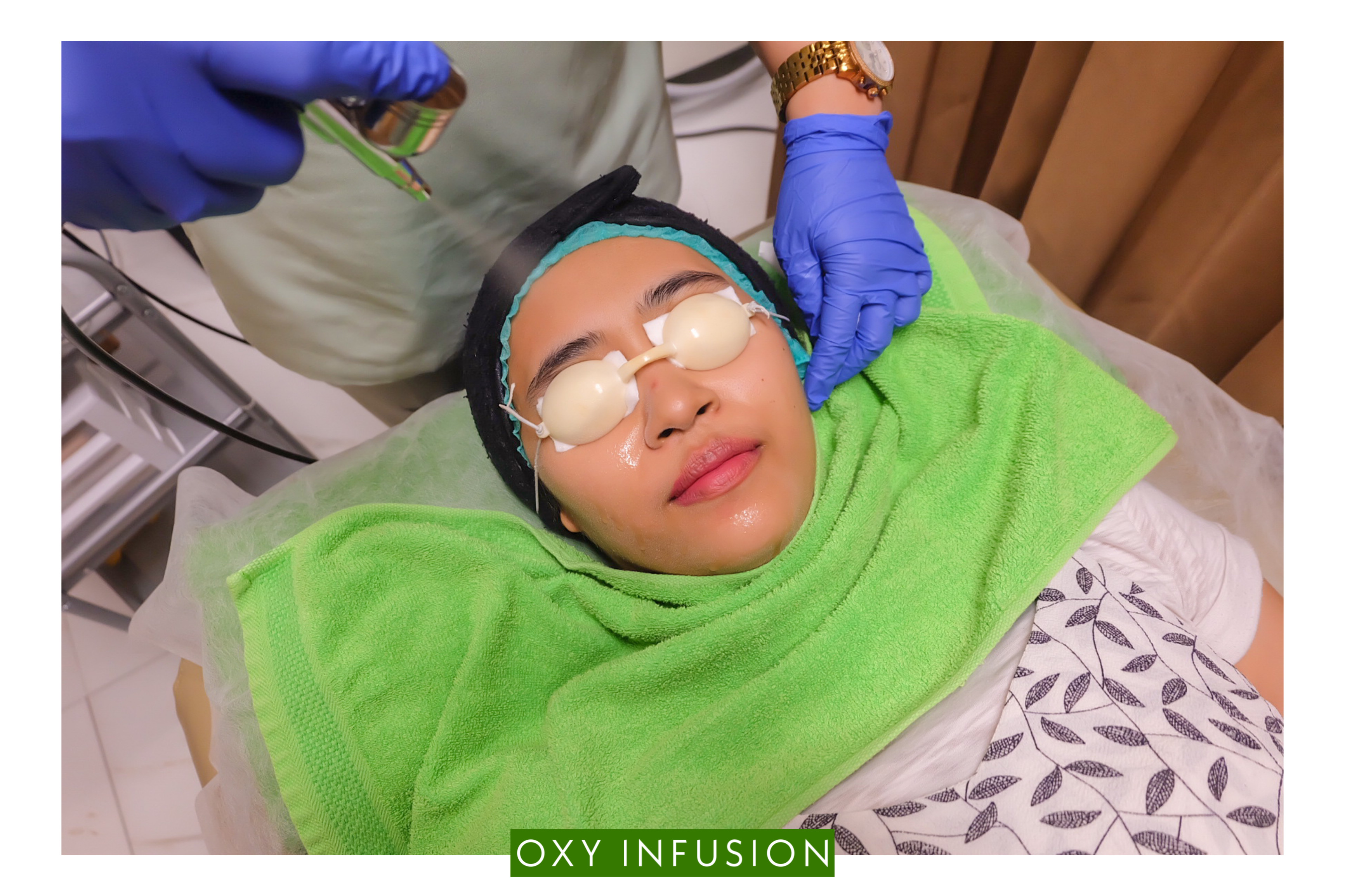 [Review] Treatment Diamond Peel di ZAP Clinic