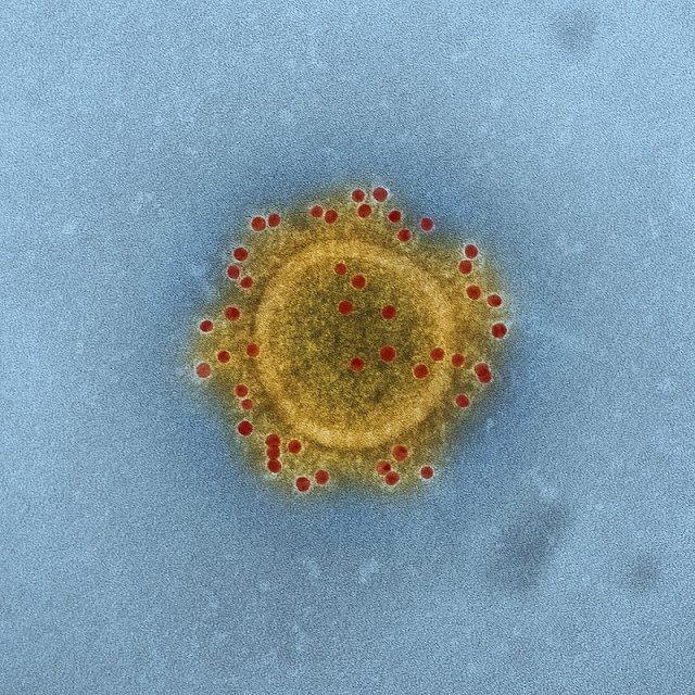 Coronavirus(COVID-19) spreads worldwide