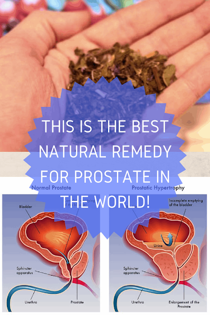 Cure An Enlarged Prostate, Diabetes, Cholesterol And Arthritis With This Natural Remedy! (Touch The Image For More Information)