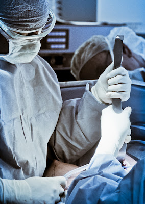 Photo of surgeon preparing to insert a silicone breast implant through an inframammary technique