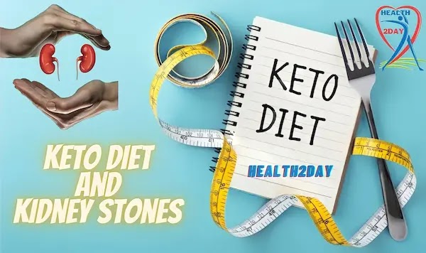 Can keto diet cause kidney stones