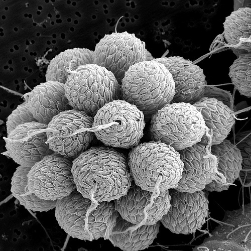 Scanning Electron Microscope Images