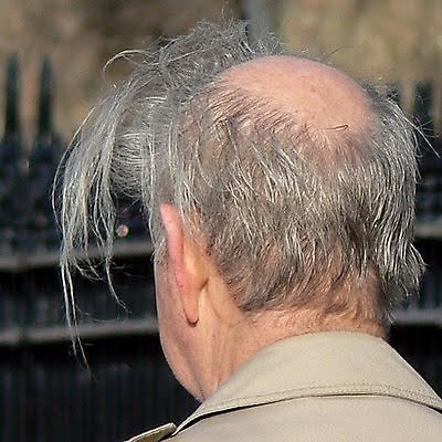 Bald men hairstyles - 29 Pics