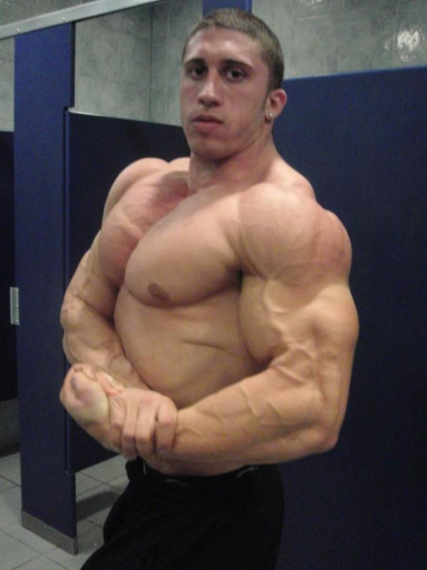 Teen Bodybuilding 2010 Winner Nicholas Nick Radici