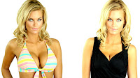 How Much Is Breast Lift Surgery