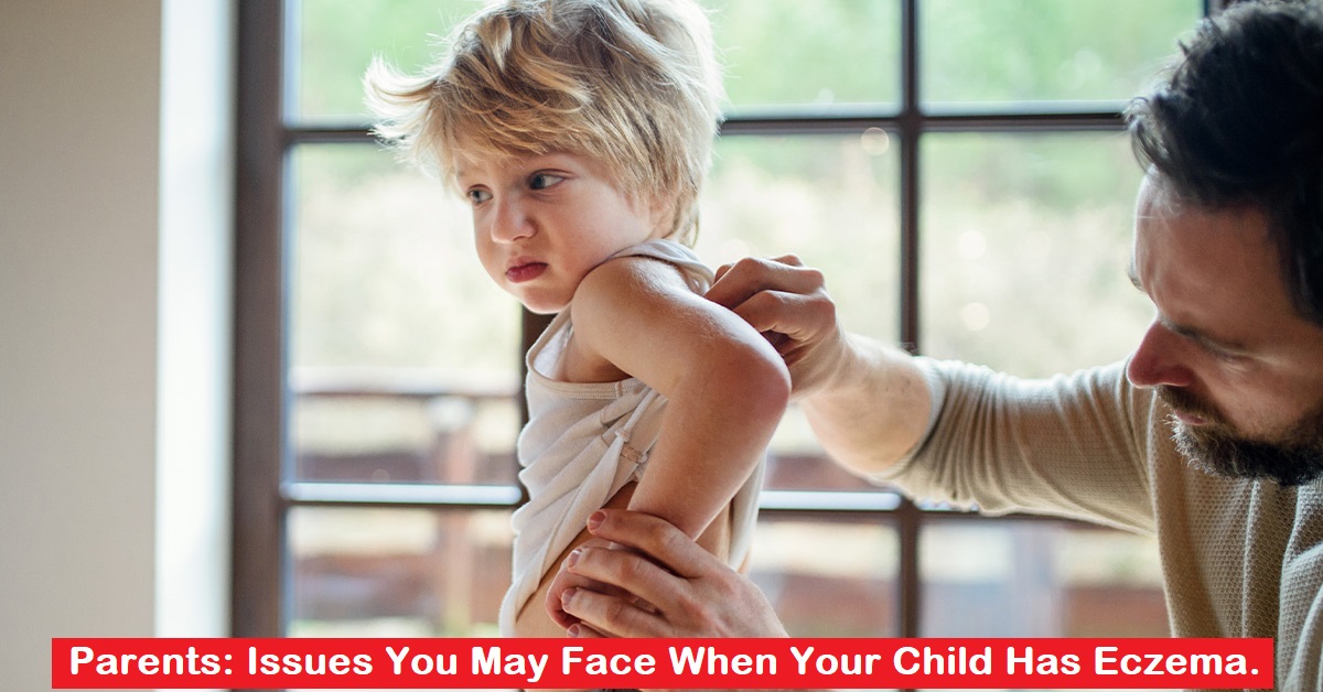 Parents: Issues You May Face When Your Child Has Eczema.