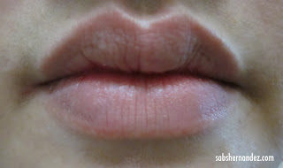 obvious natural lip line