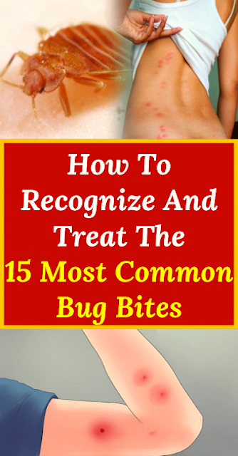 How To Recognize and Treat the 15 Most Common Bug Bites