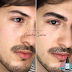 [News] Em alta! Micropigmentação labial e de preenchimento de falhas na sobrancelha conquistam os homens