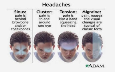 types of headache