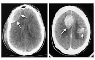 Kegunaan CT Scan