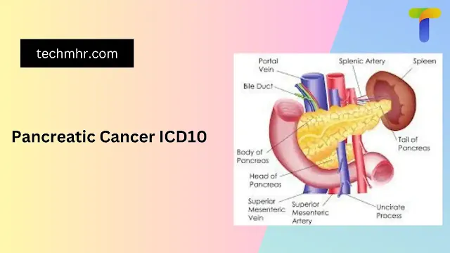 Pancreatic Cancer ICD10: How This Code Can Help Diagnose the Disease