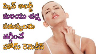 best home remedies for skin allergies in telugu