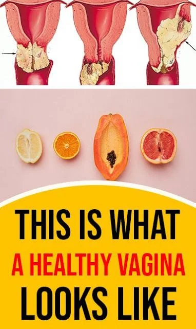 This Is What A Healthy Vagina Looks Like