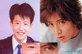 Kimura Takuya plastic surgery