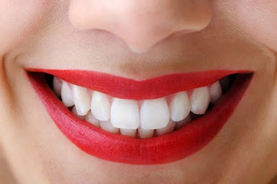 Cách điều trị răng đổi màu