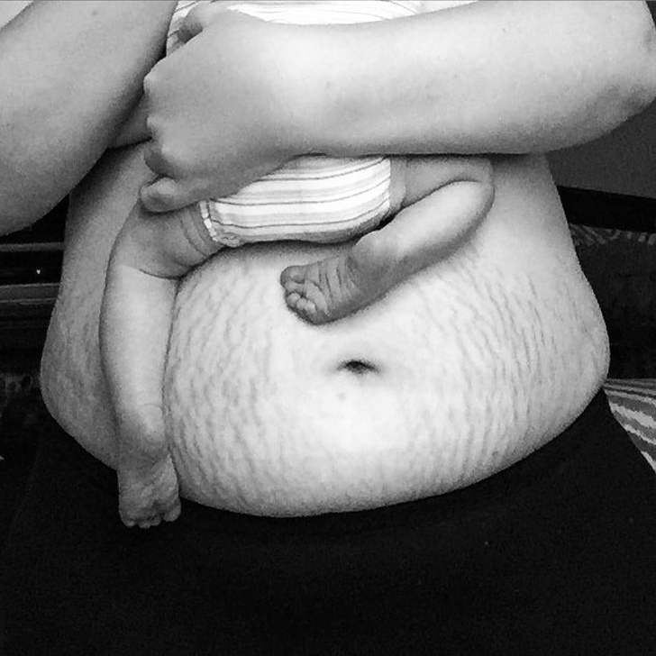 25 Women Shared Their Powerful Postpartum Pictures