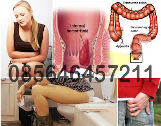 Harga Obat Wasir AMBEJOSS 500mg