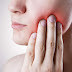 Sau khi nhổ răng khôn nên làm gì để giảm đau nhức?