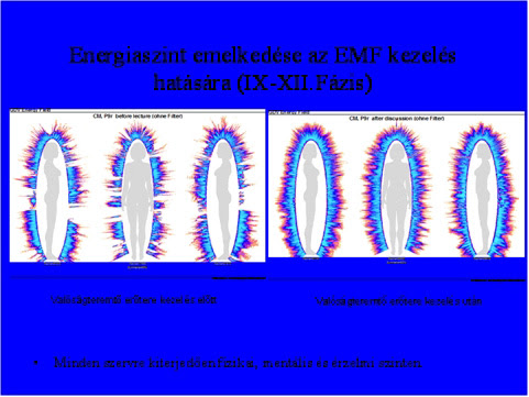 GDV - Az energiaszint emelkedése az EMF kezelés hatására