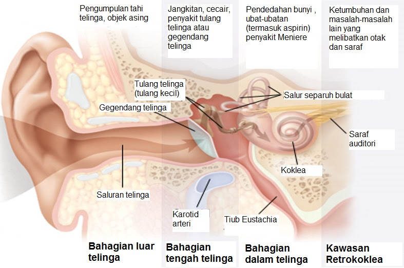 Ubat Untuk Saraf Telinga - Pertanyaan o