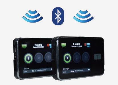 Illustration of the bionic pancreas system