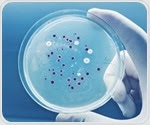 Extremely low concentrations of acetic acid could alter cellular processes in rice blast fungus