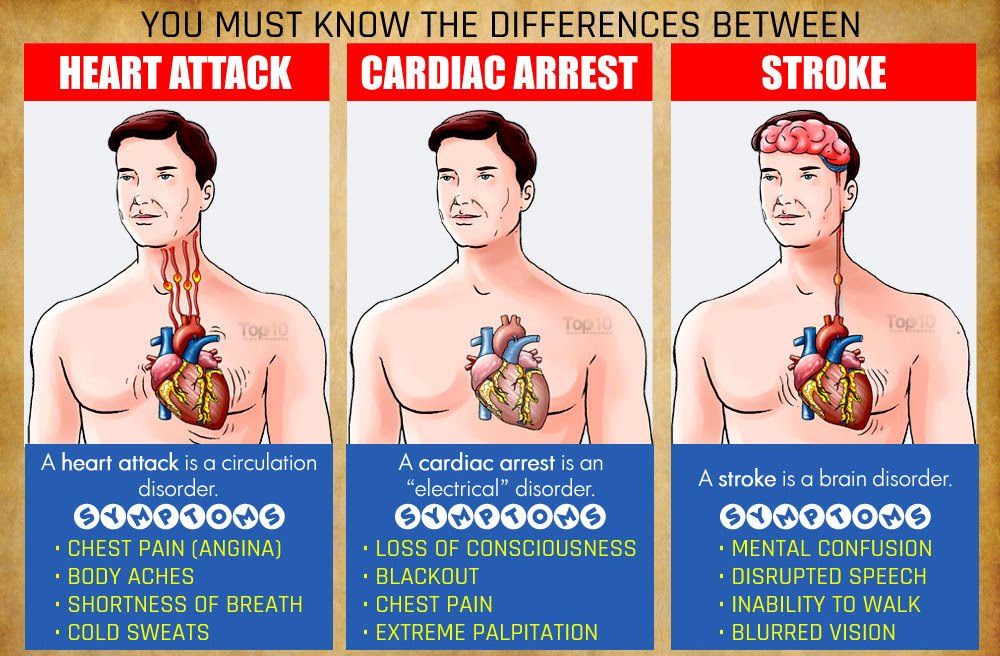 Cardiac arrest due to electrical imbalance in the heart beat that is generated continuously(heart abruptly begins to beat in an irregular or abnormal in mi heart muscle can't contribute to heart pump effectively. Do You Know The Warning Signs Of A Heart Attack Stroke Cardiac Arrest Safecare Medical Center