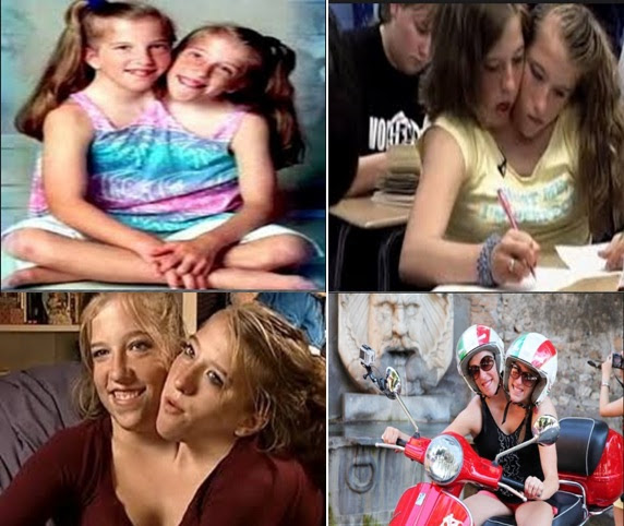 We would like to show you a description here but the site won't allow us. Abby And Brittany Hensel Restroom Conjoined Twins Abby And Brittany Prepare For Their First There S Something Fascinating About Conjoined Twins