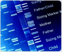 Research links DNA variants to increased risk of IBS in women