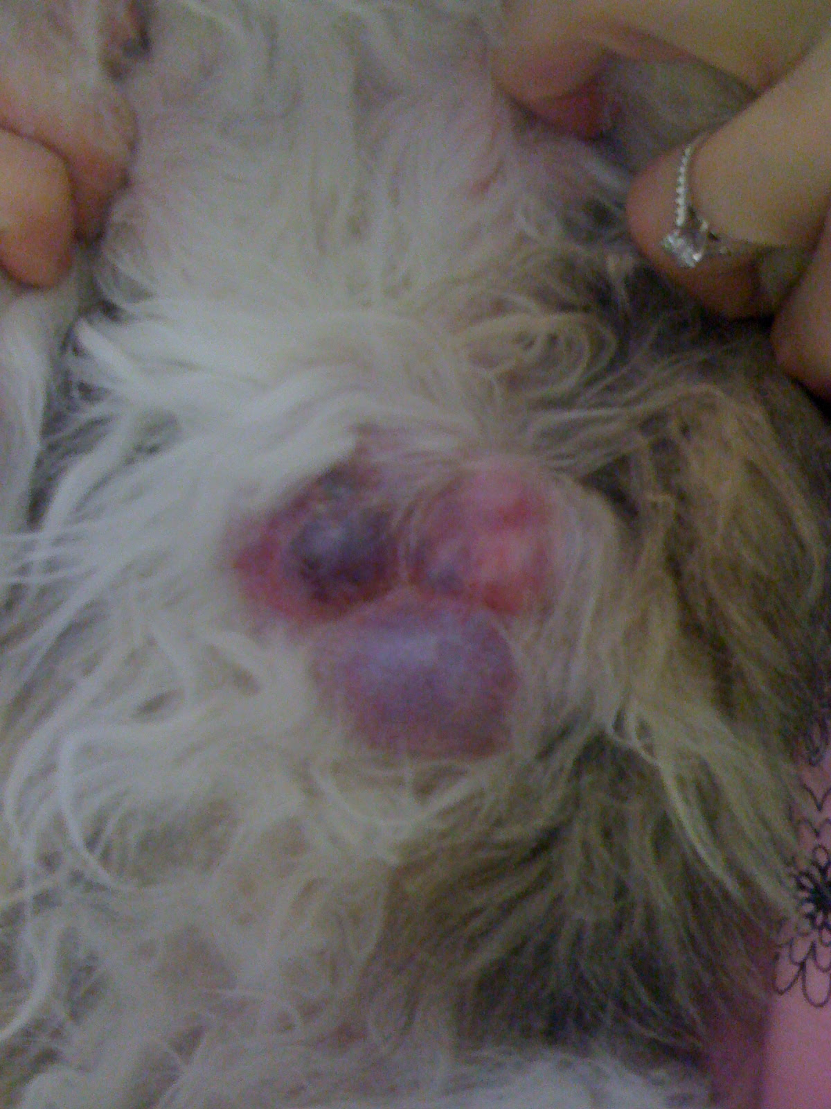 Benign Tumor In Stomach Symptoms