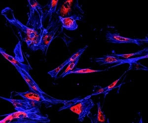 Scientists create comprehensive new method to predict breast cancer risk