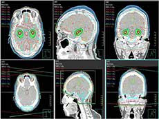 brain scan