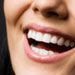 10 Habits That Harm Your Teeth