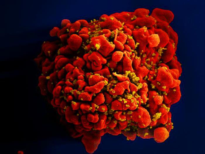 Red-colored H9-T cell