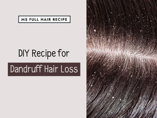 Coconut oil can be used either before or after you wash your hair depending on your hair type. Olive Oil Home Remedy Treatment For Dandruff Hair Loss Ms Full Hair Recipe