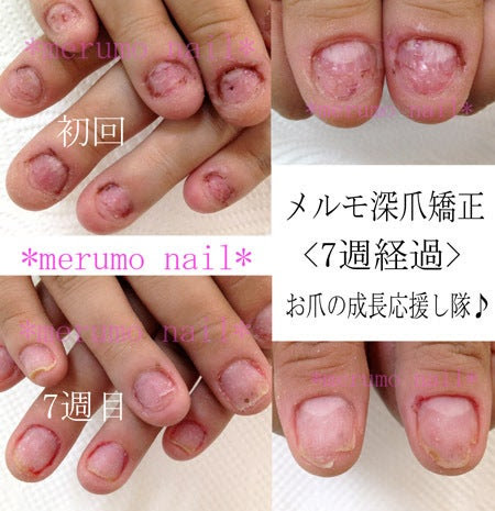 ネイル ヘッド 伸ばす ネイルアート最高の画像