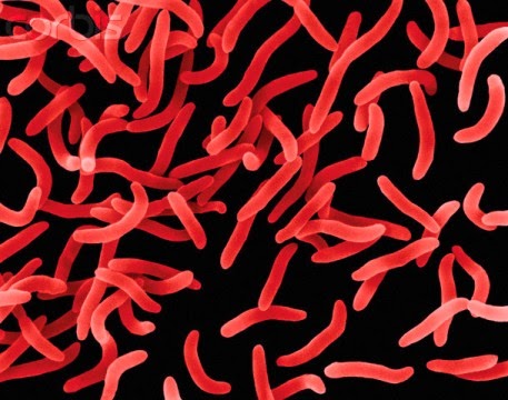 Review Jurnal Skrining Bakteri  Vibrio sp Asli Indonesia 
