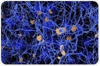 Boosting metabolic resources in the brain could be a way to slow neurodegeneration