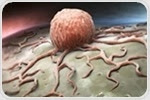 New viable therapeutic strategy found for ER+ breast cancer