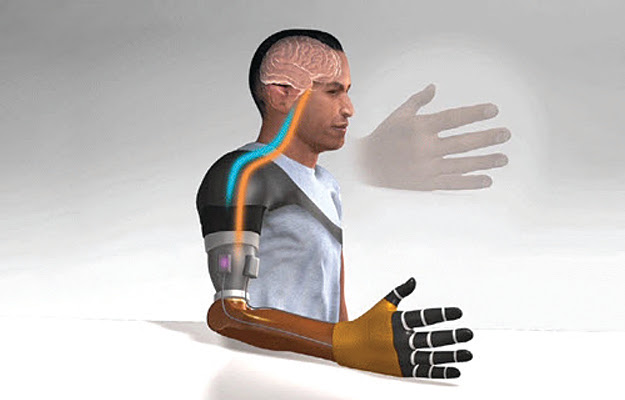 An illustration of a bionic prosthetic hand.