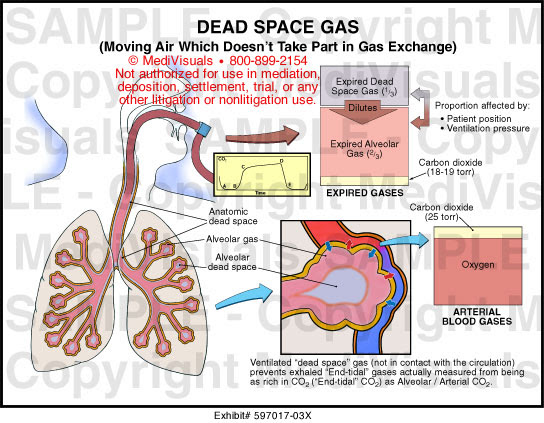 Histology Of Copd - Hirup a