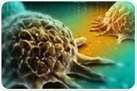 Density of immune cells could accurately predict survival in patients with stage III colon cancer
