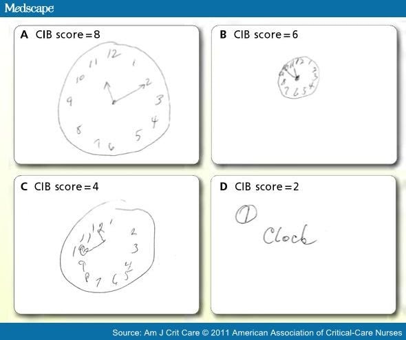 Clock Drawing Test Results : Clock-Drawing Results compared within groups (Wilcoxon ...