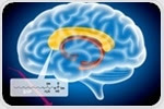 Schizophrenia related to abnormal fatty metabolism in the brain
