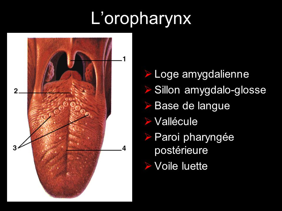 Traitement Cancer Langue