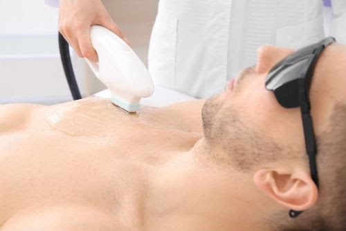 During the hair removal treatment, the hair follicles that are in the anagen stage will be destroyed. 5 Facts Men Need To Know About Laser Chest Hair Removal